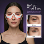 Picture of model using Ophelix LumiEye™ EMS Eye Rejuvenation Device with Red Light Therapy. Text reading 'refresh tired eyes' and example images of before and after using the device.