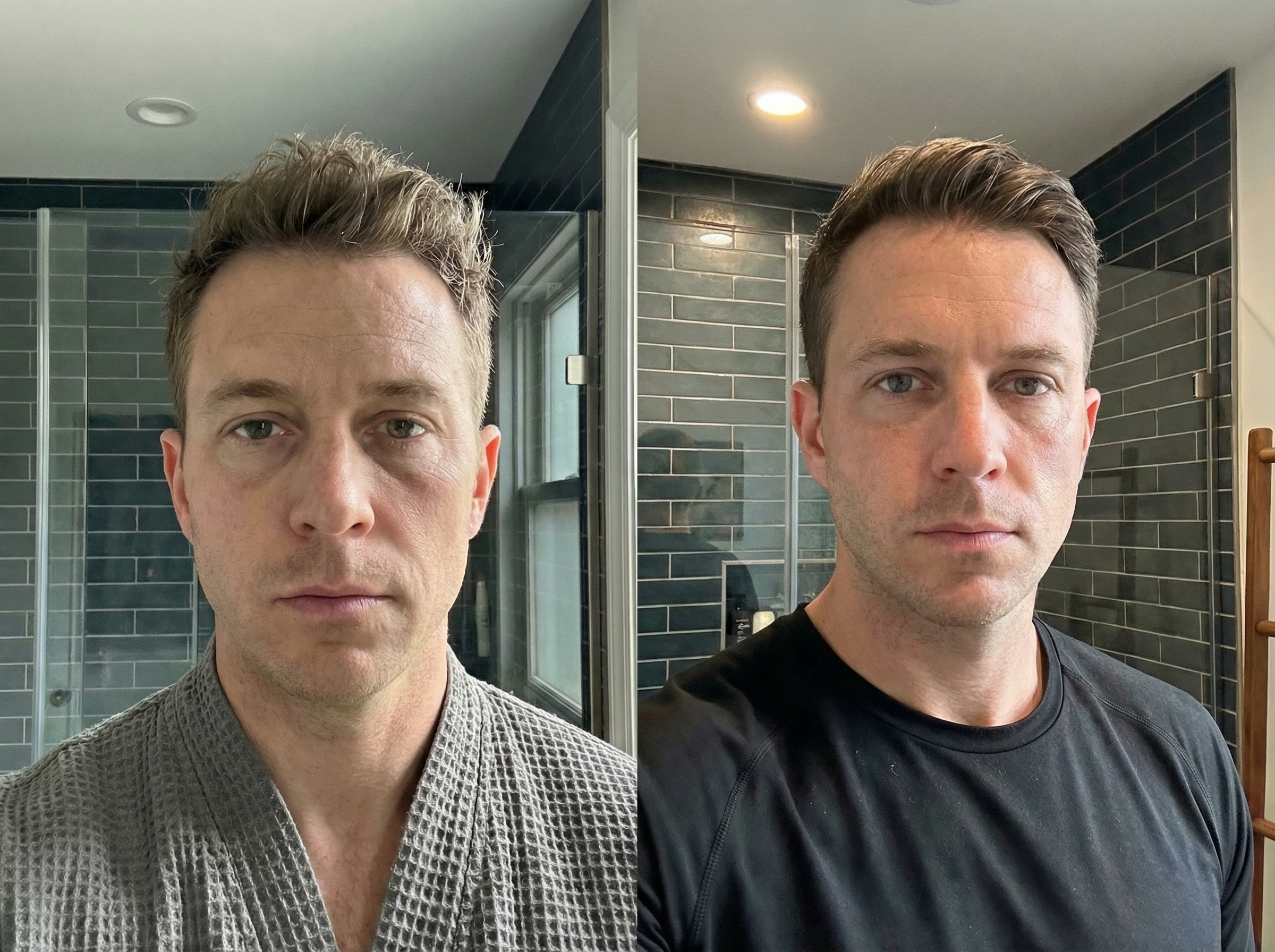 Side-by-side before and after selfies of Craig taken on different days in the same bathroom, showing subtle, natural-looking improvements in the under-eye area, with changes in clothing, lighting, and camera position for an authentic, unstaged appearance.