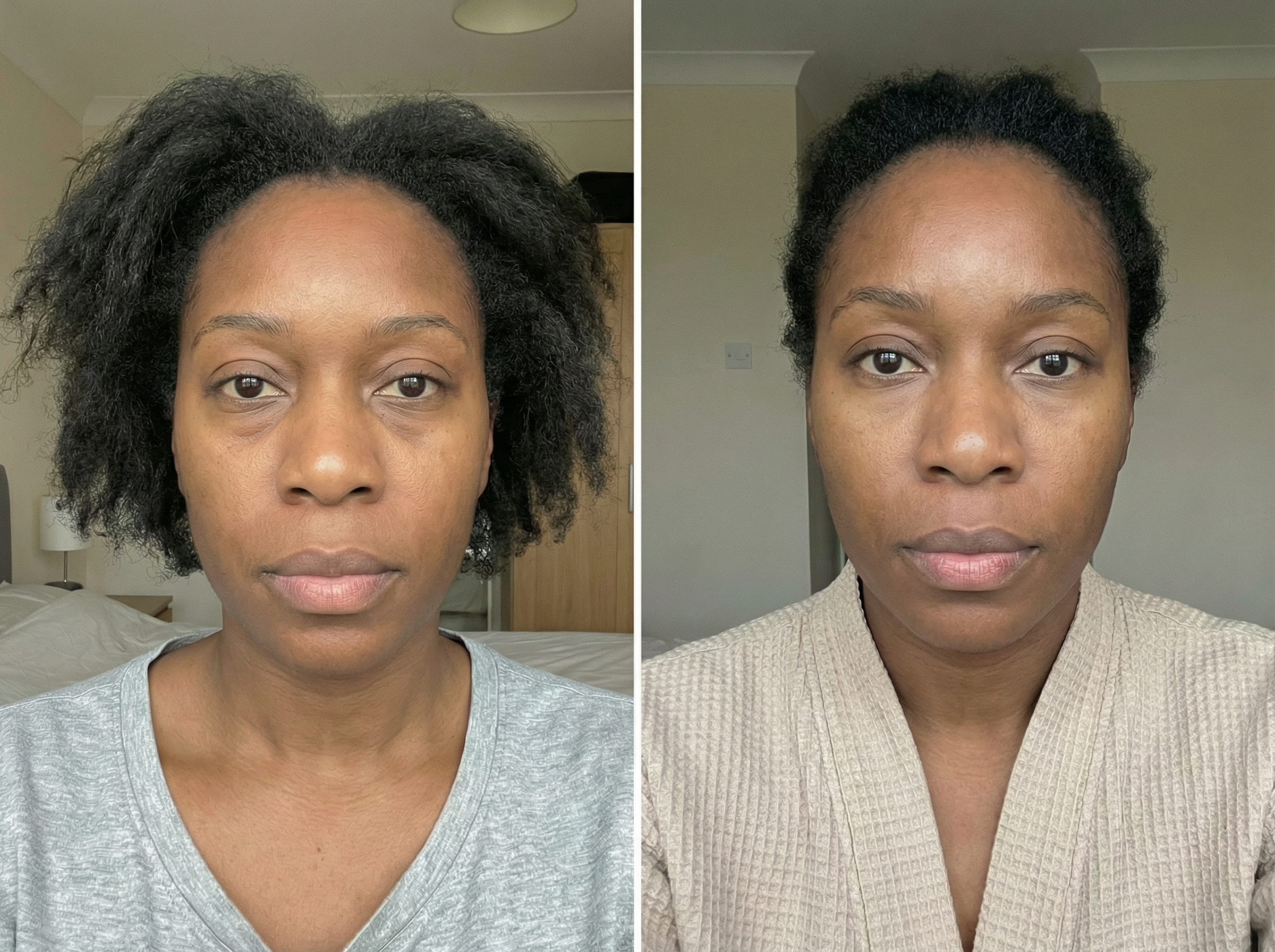 Side-by-side before and after selfies of the same woman taken on different days at home, showing subtle, natural-looking improvements in the under-eye area, with changes in hairstyle, clothing, lighting, and camera position for an authentic, unstaged appearance.