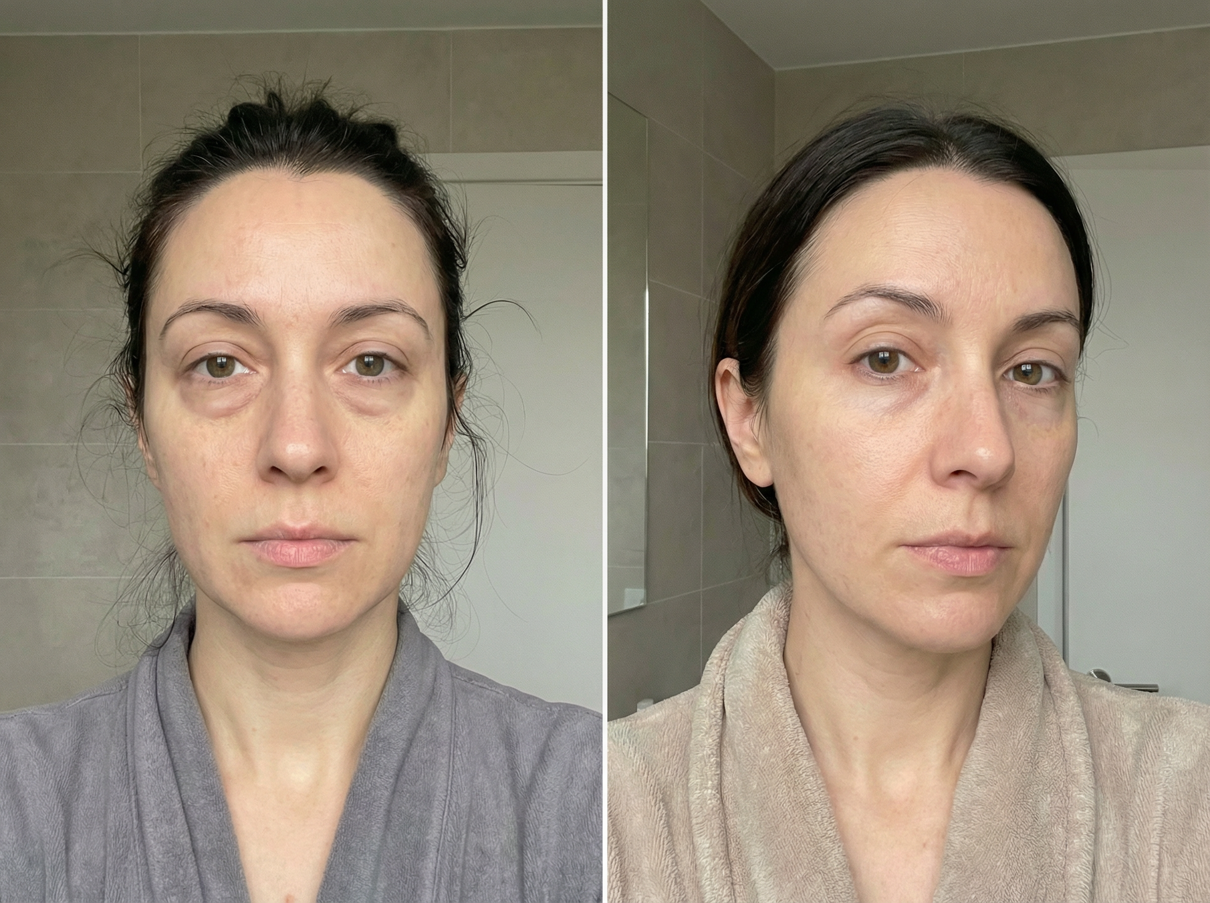 Side-by-side before and after selfies of the same woman taken on different days at home, showing subtle, natural-looking improvements in the under-eye area, with changes in hairstyle, clothing, lighting, and camera position for an authentic, unstaged appearance.